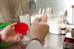 В Одессе стали меньше болеть острыми кишечными инфекциями В Одессе стали меньше болеть острыми кишечными инфекциями