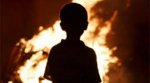 В Одесской области школьник получил ожоги В Одесской области школьник получил ожоги