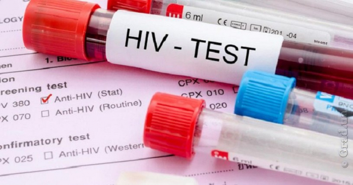 В Одесской области упали объемы закупок тестов на ВИЧ-инфекцию