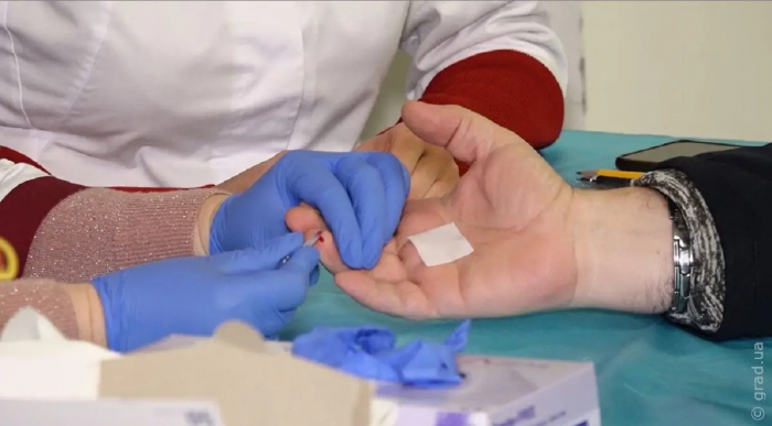 Безкоштовне тестування на ВІЛ за 15 хвилин доступно в усіх медзакладах Одесы