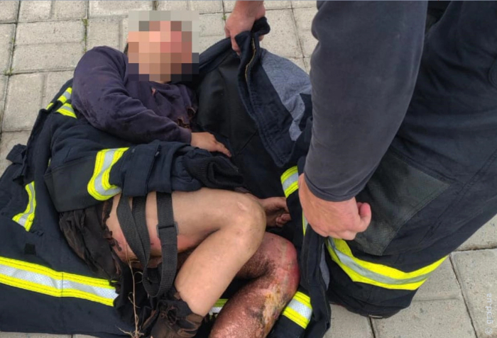 мальчик получил поражение электрическим током