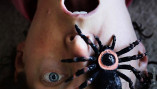Новую методику лечения от последствий укуса паука изобрели медики Измаила