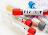 Одесситы могут бесплатно обследоваться на ВИЧ