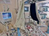 Одеські лікарі  провели  операцію на серці у дитини