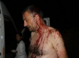 Задержаны подозреваемые в нападении на редактора Овидиопольской газеты (фото)