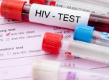 Одесситы приглашаются на обследование на ВИЧ