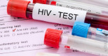 В Одесской области упали объемы закупок тестов на ВИЧ-инфекцию