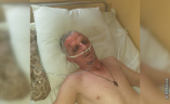 В Одесской больнице прооперировали мужчину: ищут родственников