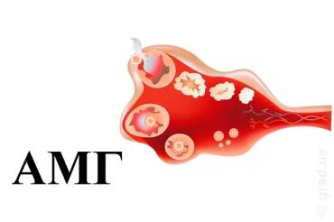 Какое значение имеет антимюллеровый гормон для беременности