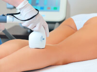 Лазерная эпиляция - в сети центров «Люменис» Киева (фото-9)