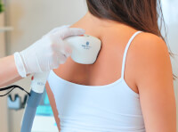 Лазерная эпиляция - в сети центров «Люменис» Киева (фото-3)