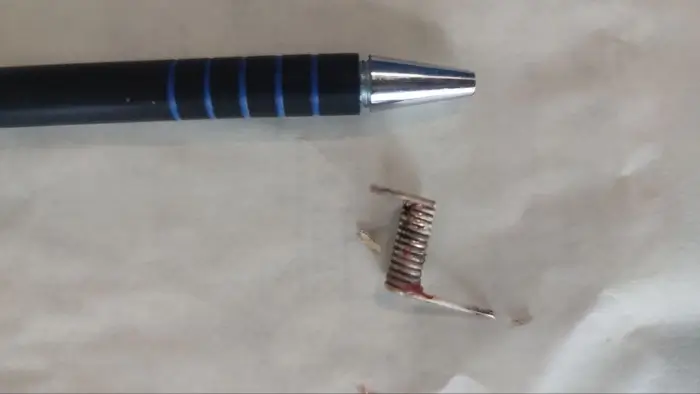 У малюка в грудях знайшли сторонній предмет